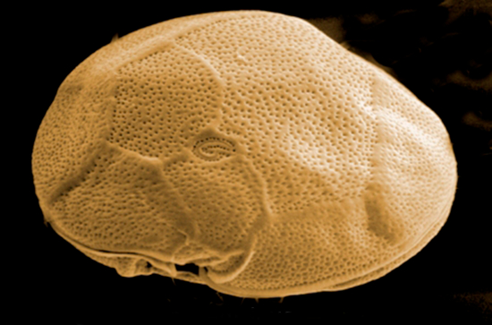Ejemplar de Gambierdiscus excentricus, investigadora principal del proyecto visto al microscopio electrónico. Imagen: IEO