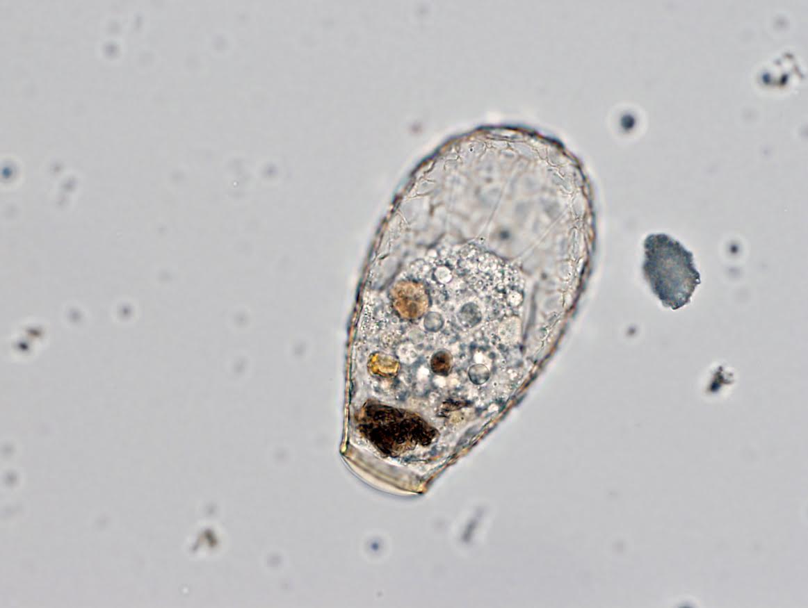 Nebela. Este protista del género Nebela es un depredador feroz que se alimenta de otros protistas, hongos y hasta pequeños animales. Fotografía: Clément Duckert, Universidad de Neuchàtel